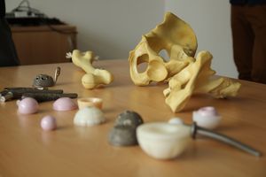 Foto: Verschiedene Objekte der Medizintechnik. Unter anderem auch Knochenplastiken liegen auf einem Tisch.